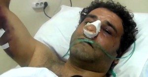 Prosperous Armenia member Artak Khachatryan lies in a hospital bed after being abducted and beaten by unknown assailants. 